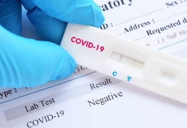 Brasil fez 24 milhões de testes de covid em um ano de pandemia