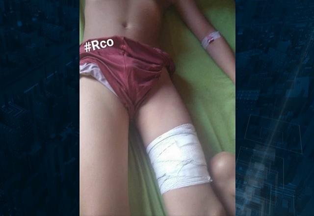 Menino de 11 anos é ferido por tubarão no litoral de SP