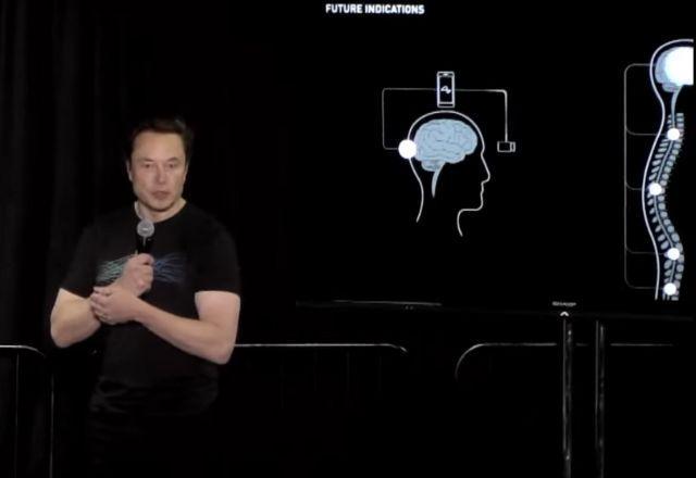 Elon Musk quer implantar chips em cérebros humanos em 2023