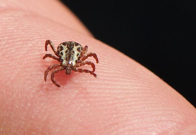 Campinas confirma mais dois casos de febre maculosa