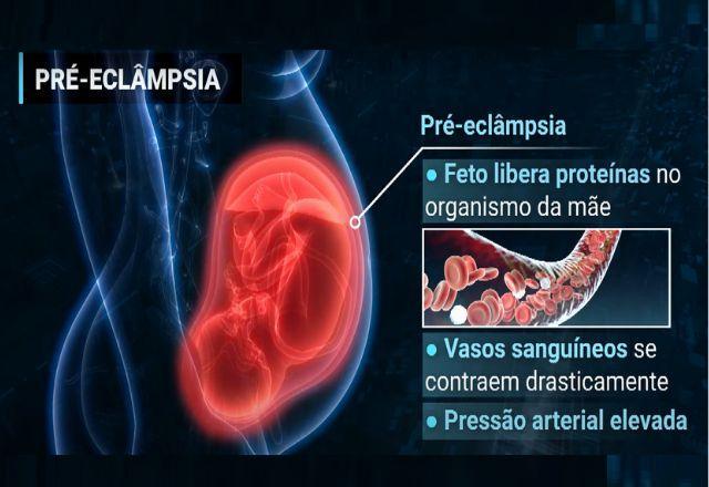 Uma gestante morre a cada três dias de eclâmpsia no Brasil